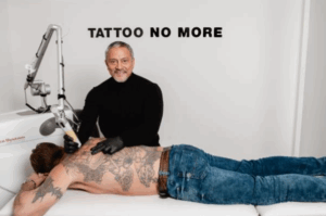 Tattoo laten verwijderen