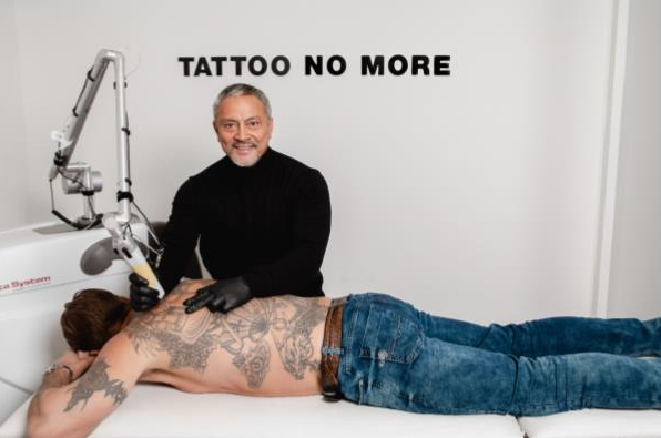 Tattoo laten verwijderen